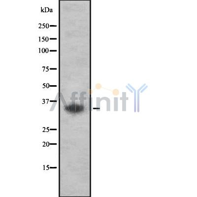 Western blot analysis of extracts from HUVEC, using OR52L2 Antibody. Lane 1 was treated with the blocking peptide.