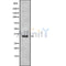DF10291 staining Hela by IF/ICC. The sample were fixed with PFA and permeabilized in 0.1% Triton X-100,then blocked in 10% serum for 45 minutes at 25¡ãC. The primary antibody was diluted at 1/200 and incubated with the sample for 1 hour at 37¡ãC. An  Alexa Fluor 594 conjugated goat anti-rabbit IgG (H+L) Ab, diluted at 1/600, was used as the secondary antibod