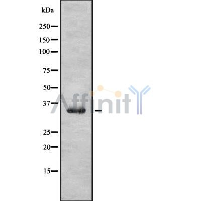 DF10291 staining Hela by IF/ICC. The sample were fixed with PFA and permeabilized in 0.1% Triton X-100,then blocked in 10% serum for 45 minutes at 25¡ãC. The primary antibody was diluted at 1/200 and incubated with the sample for 1 hour at 37¡ãC. An  Alexa Fluor 594 conjugated goat anti-rabbit IgG (H+L) Ab, diluted at 1/600, was used as the secondary antibod