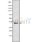 Western blot analysis OR56A4/5 using HUVEC whole cell lysates