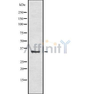 Western blot analysis OR56A4/5 using HUVEC whole cell lysates