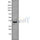 Western blot analysis OR1C1 using COLO205 whole cell lysates
