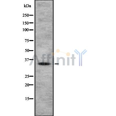 Western blot analysis OR4A47 using HeLa whole cell lysates