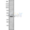 DF10297 at 1/100 staining Human liver cancer tissue by IHC-P. The sample was formaldehyde fixed and a heat mediated antigen retrieval step in citrate buffer was performed. The sample was then blocked and incubated with the antibody for 1.5 hours at 22¡ãC. An HRP conjugated goat anti-rabbit antibody was used as the secondary