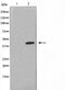 Western blot analysis on HepG2 cell lysate using 5-HT-1A Antibody,The lane on the left is treated with the antigen-specific peptide.