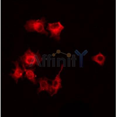AF0482 staining HepG2 by IF/ICC. The sample were fixed with PFA and permeabilized in 0.1% Triton X-100,then blocked in 10% serum for 45 minutes at 25¡ãC. The primary antibody was diluted at 1/200 and incubated with the sample for 1 hour at 37¡ãC. An  Alexa Fluor 594 conjugated goat anti-rabbit IgG (H+L) Ab, diluted at 1/600, was used as the secondary antibod