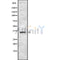 Western blot analysis of extracts from various samples, using TAS2R42 Antibody.
 Lane 1: Rat  spleen treated with blocking peptide;
 Lane 2: Rat  spleen;
 Lane 3: Rat  lung.