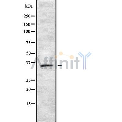 Western blot analysis of extracts from various samples, using TAS2R42 Antibody.
 Lane 1: Rat  spleen treated with blocking peptide;
 Lane 2: Rat  spleen;
 Lane 3: Rat  lung.