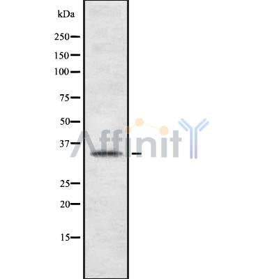 Western blot analysis of extracts from rat muscle, using TAS2R44 Antibody.