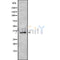 Western blot analysis of HCG39951 using 293 whole cell lysates