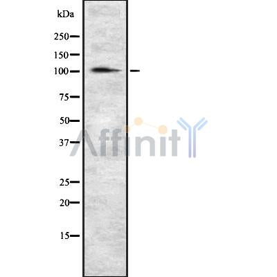 Western blot analysis of extracts from mouse lung, using Klotho Antibody. Lane 1 was treated with the blocking peptide.