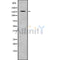 Western blot analysis of CFTR using HUVEC whole cell lysates