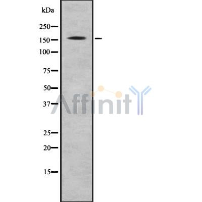 Western blot analysis of CFTR using HUVEC whole cell lysates