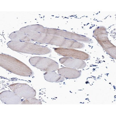 Western blot analysis of extracts from Hela, using Collagen Valpha 1 Antibody.