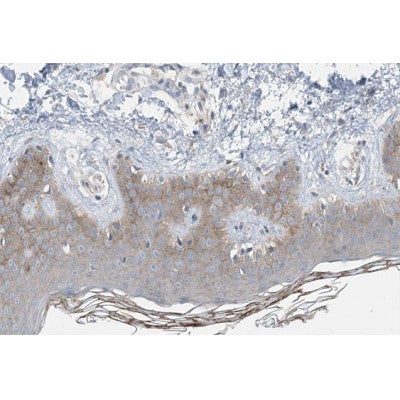 AF0573 staining HepG2 by IF/ICC. The sample were fixed with PFA and permeabilized in 0.1% Triton X-100,then blocked in 10% serum for 45 minutes at 25¡ãC. The primary antibody was diluted at 1/200 and incubated with the sample for 1 hour at 37¡ãC. An  Alexa Fluor 594 conjugated goat anti-rabbit IgG (H+L) Ab, diluted at 1/600, was used as the secondary antibod