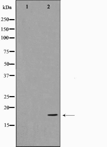 AF0761 staining Hela by IF/ICC. The sample were fixed with PFA and permeabilized in 0.1% Triton X-100,then blocked in 10% serum for 45 minutes at 25¡ãC. The primary antibody was diluted at 1/200 and incubated with the sample for 1 hour at 37¡ãC. An  Alexa Fluor 594 conjugated goat anti-rabbit IgG (H+L) Ab, diluted at 1/600, was used as the secondary antibod