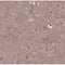 AF0623 staining HepG2 by IF/ICC. The sample were fixed with PFA and permeabilized in 0.1% Triton X-100,then blocked in 10% serum for 45 minutes at 25¡ãC. The primary antibody was diluted at 1/200 and incubated with the sample for 1 hour at 37¡ãC. An  Alexa Fluor 594 conjugated goat anti-rabbit IgG (H+L) Ab, diluted at 1/600, was used as the secondary antibod