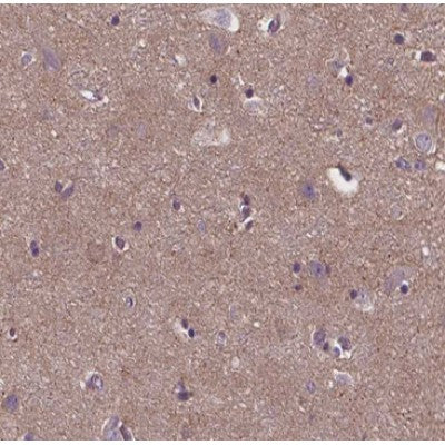 AF0623 staining HepG2 by IF/ICC. The sample were fixed with PFA and permeabilized in 0.1% Triton X-100,then blocked in 10% serum for 45 minutes at 25¡ãC. The primary antibody was diluted at 1/200 and incubated with the sample for 1 hour at 37¡ãC. An  Alexa Fluor 594 conjugated goat anti-rabbit IgG (H+L) Ab, diluted at 1/600, was used as the secondary antibod