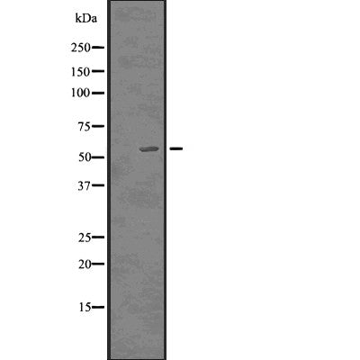 DF2993 staining K562 by IF/ICC. The sample were fixed with PFA and permeabilized in 0.1% Triton X-100,then blocked in 10% serum for 45 minutes at 25¡ãC. The primary antibody was diluted at 1/200 and incubated with the sample for 1 hour at 37¡ãC. An  Alexa Fluor 594 conjugated goat anti-rabbit IgG (H+L) Ab, diluted at 1/600, was used as the secondary antibod