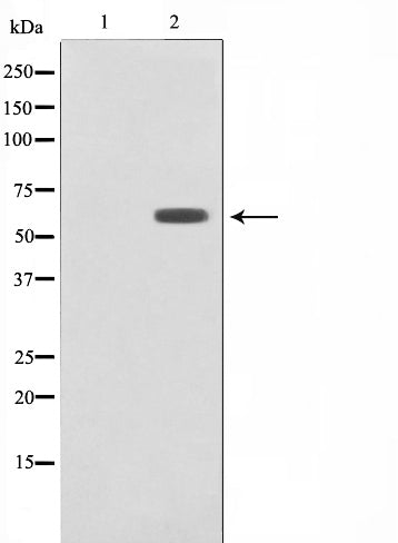 Western blot analysis on HepG2 cell lysate using Cytochrome P450 26A1 Antibody,The lane on the left is treated with the antigen-specific peptide.