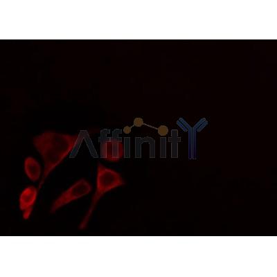 AF0473 staining HepG2 cells by IF/ICC. The sample were fixed with PFA and permeabilized in 0.1% Triton X-100,then blocked in 10% serum for 45 minutes at 25¡ãC. The primary antibody was diluted at 1/200 and incubated with the sample for 1 hour at 37¡ãC. An  Alexa Fluor 594 conjugated goat anti-rabbit IgG (H+L) antibody(Cat.