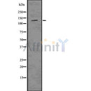 DF7500 at 1/100 staining Human lymph node tissue by IHC-P. The sample was formaldehyde fixed and a heat mediated antigen retrieval step in citrate buffer was performed. The sample was then blocked and incubated with the antibody for 1.5 hours at 22¡ãC. An HRP conjugated goat anti-rabbit antibody was used as the secondary