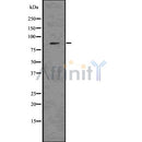 DF7501 at 1/100 staining Human kidney tissue by IHC-P. The sample was formaldehyde fixed and a heat mediated antigen retrieval step in citrate buffer was performed. The sample was then blocked and incubated with the antibody for 1.5 hours at 22¡ãC. An HRP conjugated goat anti-rabbit antibody was used as the secondary