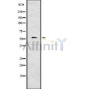 DF7503 at 1/100 staining Human liver tissue by IHC-P. The sample was formaldehyde fixed and a heat mediated antigen retrieval step in citrate buffer was performed. The sample was then blocked and incubated with the antibody for 1.5 hours at 22¡ãC. An HRP conjugated goat anti-rabbit antibody was used as the secondary