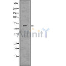 Western blot analysis of extracts from Huvec, using Occludin Antibody. The lane on the left was treated with blocking peptide.