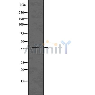 DF7505 at 1/100 staining Human lymph node tissue by IHC-P. The sample was formaldehyde fixed and a heat mediated antigen retrieval step in citrate buffer was performed. The sample was then blocked and incubated with the antibody for 1.5 hours at 22¡ãC. An HRP conjugated goat anti-rabbit antibody was used as the secondary