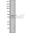 Western blot analysis of extracts from HepG2, using CCR2 Antibody. Lane 1 was treated with the blocking peptide.