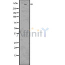 DF7511 at 1/100 staining Human breast cancer tissue by IHC-P. The sample was formaldehyde fixed and a heat mediated antigen retrieval step in citrate buffer was performed. The sample was then blocked and incubated with the antibody for 1.5 hours at 22¡ãC. An HRP conjugated goat anti-rabbit antibody was used as the secondary