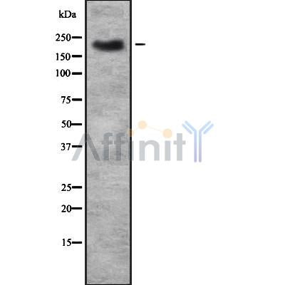 DF7513 at 1/100 staining Human urothelial cancer tissue by IHC-P. The sample was formaldehyde fixed and a heat mediated antigen retrieval step in citrate buffer was performed. The sample was then blocked and incubated with the antibody for 1.5 hours at 22¡ãC. An HRP conjugated goat anti-rabbit antibody was used as the secondary