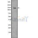 DF7514 at 1/100 staining Mouse testis tissue by IHC-P. The sample was formaldehyde fixed and a heat mediated antigen retrieval step in citrate buffer was performed. The sample was then blocked and incubated with the antibody for 1.5 hours at 22¡ãC. An HRP conjugated goat anti-rabbit antibody was used as the secondary