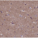 AF0384 at 1/100 staining human brain tissue sections by IHC-P. The tissue was formaldehyde fixed and a heat mediated antigen retrieval step in citrate buffer was performed. The tissue was then blocked and incubated with the antibody for 1.5 hours at 22¡ãC. An HRP conjugated goat anti-rabbit antibody was used as the secondary