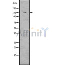 DF7516 at 1/100 staining Human lung tissue by IHC-P. The sample was formaldehyde fixed and a heat mediated antigen retrieval step in citrate buffer was performed. The sample was then blocked and incubated with the antibody for 1.5 hours at 22¡ãC. An HRP conjugated goat anti-rabbit antibody was used as the secondary