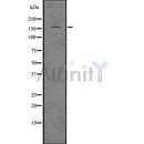 DF7517 staining Hela by IF/ICC. The sample were fixed with PFA and permeabilized in 0.1% Triton X-100,then blocked in 10% serum for 45 minutes at 25¡ãC. The primary antibody was diluted at 1/200 and incubated with the sample for 1 hour at 37¡ãC. An  Alexa Fluor 594 conjugated goat anti-rabbit IgG (H+L) Ab, diluted at 1/600, was used as the secondary antibod