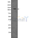 DF7523 staining HepG2 by IF/ICC. The sample were fixed with PFA and permeabilized in 0.1% Triton X-100,then blocked in 10% serum for 45 minutes at 25¡ãC. The primary antibody was diluted at 1/200 and incubated with the sample for 1 hour at 37¡ãC. An  Alexa Fluor 594 conjugated goat anti-rabbit IgG (H+L) Ab, diluted at 1/600, was used as the secondary antibod