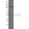 DF7523 staining HepG2 by IF/ICC. The sample were fixed with PFA and permeabilized in 0.1% Triton X-100,then blocked in 10% serum for 45 minutes at 25¡ãC. The primary antibody was diluted at 1/200 and incubated with the sample for 1 hour at 37¡ãC. An  Alexa Fluor 594 conjugated goat anti-rabbit IgG (H+L) Ab, diluted at 1/600, was used as the secondary antibod