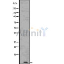 DF7524 at 1/100 staining Human pancreas tissue by IHC-P. The sample was formaldehyde fixed and a heat mediated antigen retrieval step in citrate buffer was performed. The sample was then blocked and incubated with the antibody for 1.5 hours at 22¡ãC. An HRP conjugated goat anti-rabbit antibody was used as the secondary