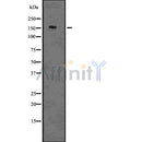 DF7525 at 1/100 staining Human gastric tissue by IHC-P. The sample was formaldehyde fixed and a heat mediated antigen retrieval step in citrate buffer was performed. The sample was then blocked and incubated with the antibody for 1.5 hours at 22¡ãC. An HRP conjugated goat anti-rabbit antibody was used as the secondary