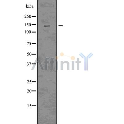 DF7527 at 1/100 staining Mouse kidney tissue by IHC-P. The sample was formaldehyde fixed and a heat mediated antigen retrieval step in citrate buffer was performed. The sample was then blocked and incubated with the antibody for 1.5 hours at 22¡ãC. An HRP conjugated goat anti-rabbit antibody was used as the secondary