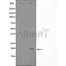 DF7528 at 1/100 staining Human lung tissue by IHC-P. The sample was formaldehyde fixed and a heat mediated antigen retrieval step in citrate buffer was performed. The sample was then blocked and incubated with the antibody for 1.5 hours at 22¡ãC. An HRP conjugated goat anti-rabbit antibody was used as the secondary