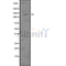 DF7529 at 1/100 staining Human breast cancer tissue by IHC-P. The sample was formaldehyde fixed and a heat mediated antigen retrieval step in citrate buffer was performed. The sample was then blocked and incubated with the antibody for 1.5 hours at 22¡ãC. An HRP conjugated goat anti-rabbit antibody was used as the secondary