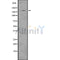 DF7530 at 1/100 staining Human prostate tissue by IHC-P. The sample was formaldehyde fixed and a heat mediated antigen retrieval step in citrate buffer was performed. The sample was then blocked and incubated with the antibody for 1.5 hours at 22¡ãC. An HRP conjugated goat anti-rabbit antibody was used as the secondary