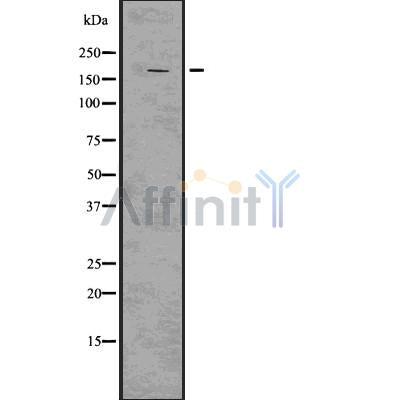 DF7530 at 1/100 staining Human prostate tissue by IHC-P. The sample was formaldehyde fixed and a heat mediated antigen retrieval step in citrate buffer was performed. The sample was then blocked and incubated with the antibody for 1.5 hours at 22¡ãC. An HRP conjugated goat anti-rabbit antibody was used as the secondary