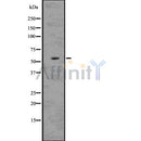 DF7532 at 1/100 staining Rat lung tissue by IHC-P. The sample was formaldehyde fixed and a heat mediated antigen retrieval step in citrate buffer was performed. The sample was then blocked and incubated with the antibody for 1.5 hours at 22¡ãC. An HRP conjugated goat anti-rabbit antibody was used as the secondary