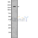 DF7533 at 1/100 staining Human brain cancer tissue by IHC-P. The sample was formaldehyde fixed and a heat mediated antigen retrieval step in citrate buffer was performed. The sample was then blocked and incubated with the antibody for 1.5 hours at 22¡ãC. An HRP conjugated goat anti-rabbit antibody was used as the secondary