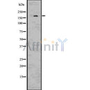 DF7534 at 1/100 staining Human prostate tissue by IHC-P. The sample was formaldehyde fixed and a heat mediated antigen retrieval step in citrate buffer was performed. The sample was then blocked and incubated with the antibody for 1.5 hours at 22¡ãC. An HRP conjugated goat anti-rabbit antibody was used as the secondary