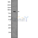 DF7535 staining Hela by IF/ICC. The sample were fixed with PFA and permeabilized in 0.1% Triton X-100,then blocked in 10% serum for 45 minutes at 25¡ãC. The primary antibody was diluted at 1/200 and incubated with the sample for 1 hour at 37¡ãC. An  Alexa Fluor 594 conjugated goat anti-rabbit IgG (H+L) Ab, diluted at 1/600, was used as the secondary antibod